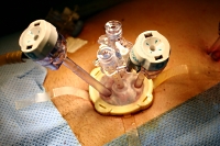 既存の手術器具を改良利用した腹腔鏡下結腸切除術