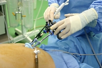 専用の手術器具を利用した腹腔鏡下胆嚢摘出術