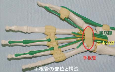 手 根 管 症候群 手術