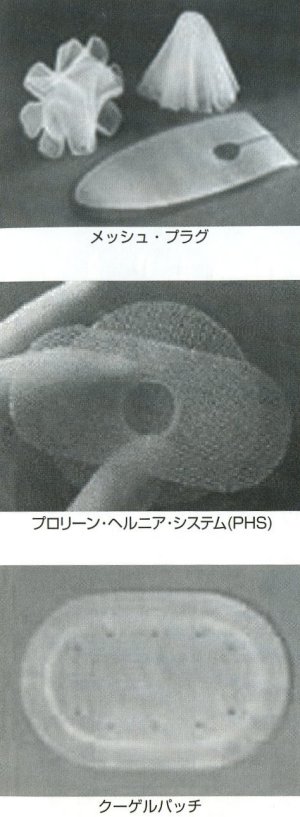 セレブレックスの副作用勃起不全