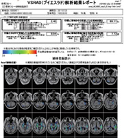 認知症とMRI_図1