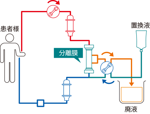 西陣病院、PEについて