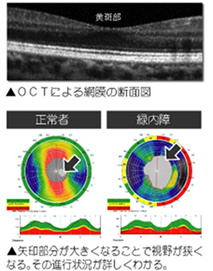 西陣病院、眼科用超音波診断装置