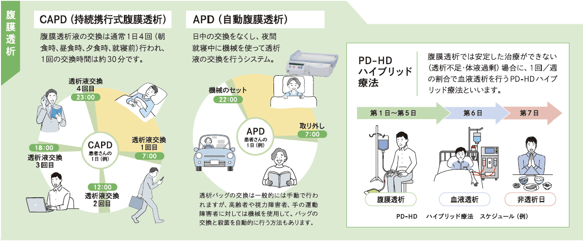 腹膜透析外来